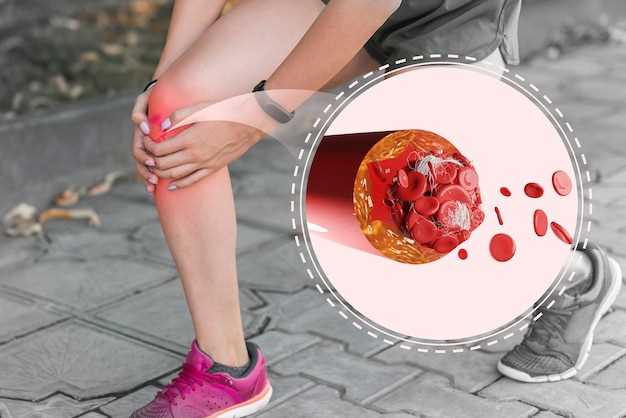 How Duloxetine Helps Relieve Leg Pain