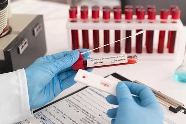 Duloxetine blood levels