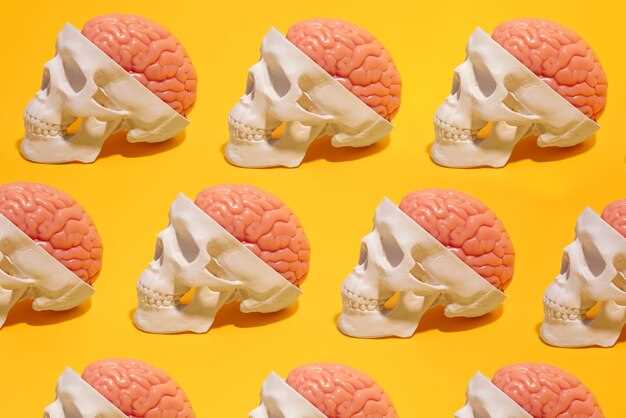 Duloxetine brain zaps