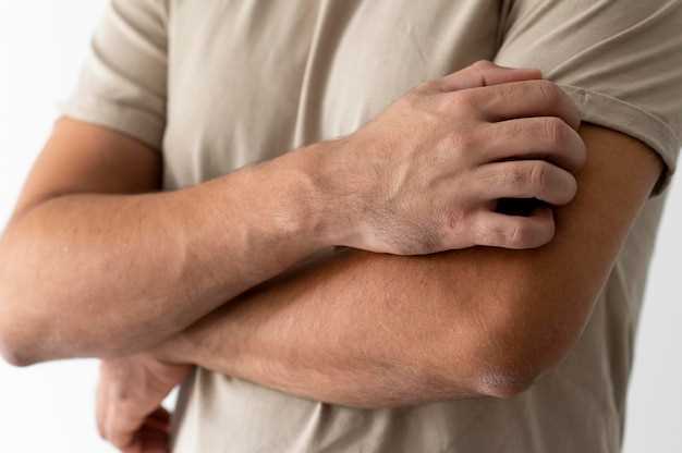 Duloxetine side effects rash