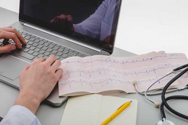 Duloxetine tachycardia