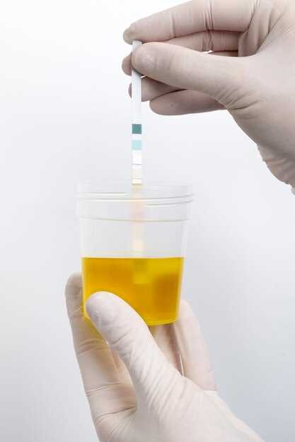 Duloxetine urine test
